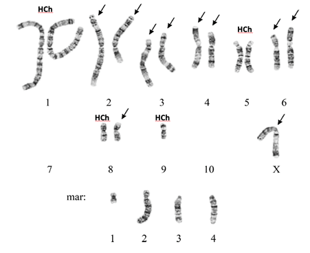 Karyotype of CHO cell line DXB-11